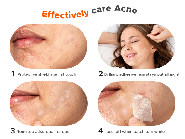 large pimple patches