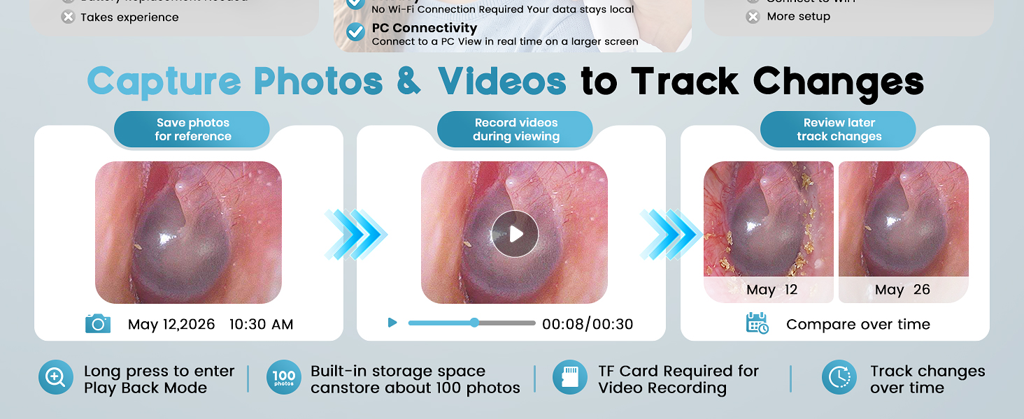 otoscope