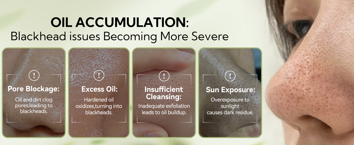 oil accumulation