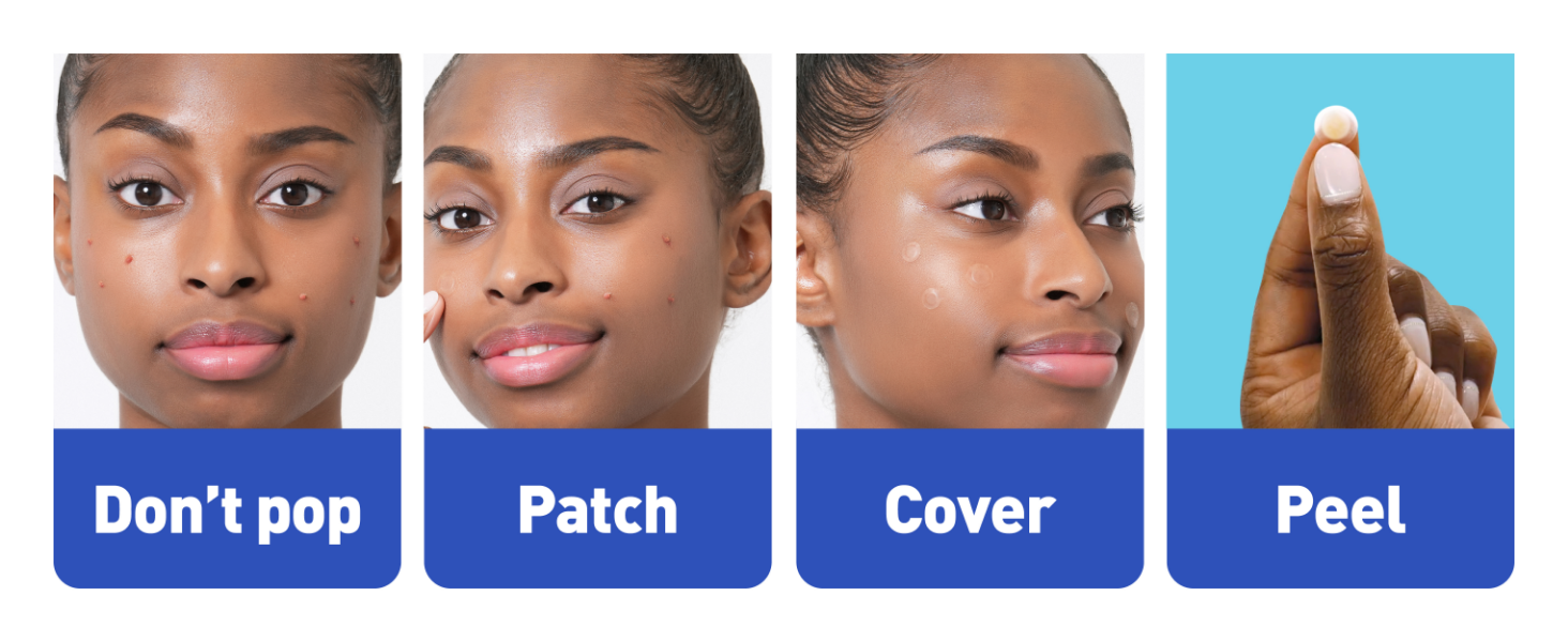 mighty patch pimple patch hero pimple patch