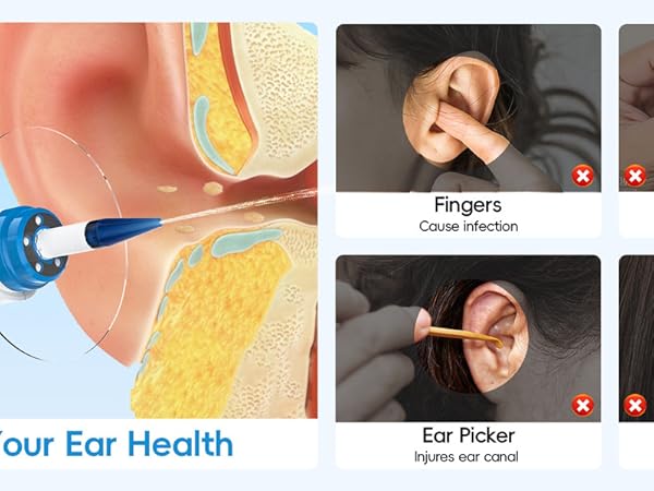 Electric Ear Wax Removal Kit