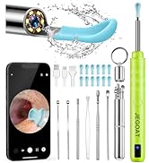 Ear Wax Removal Tool Camera, Ear Cleaner with Camera, Ear Cleaning Kit 1296P HD Ear Scope, 6 LED ...