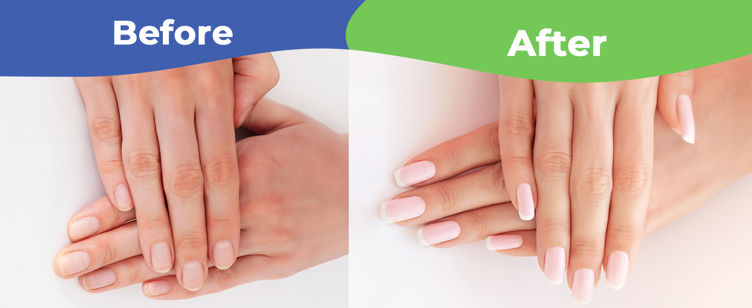 Cuticle Cutter