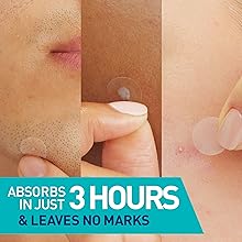 CeraVe Blemish Patches How to Use