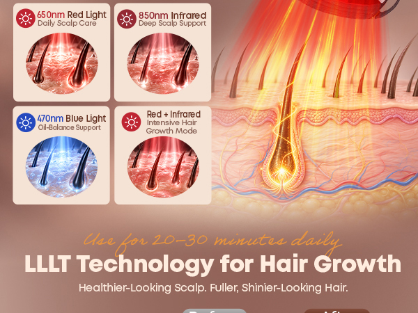 Laser Hair Growth Cap