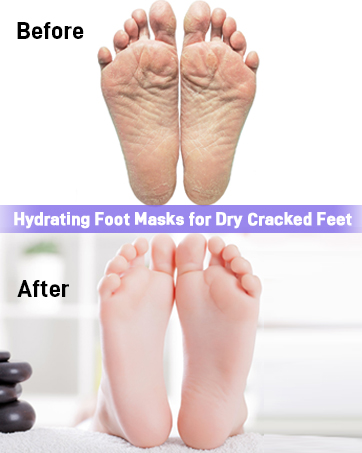 foot mask