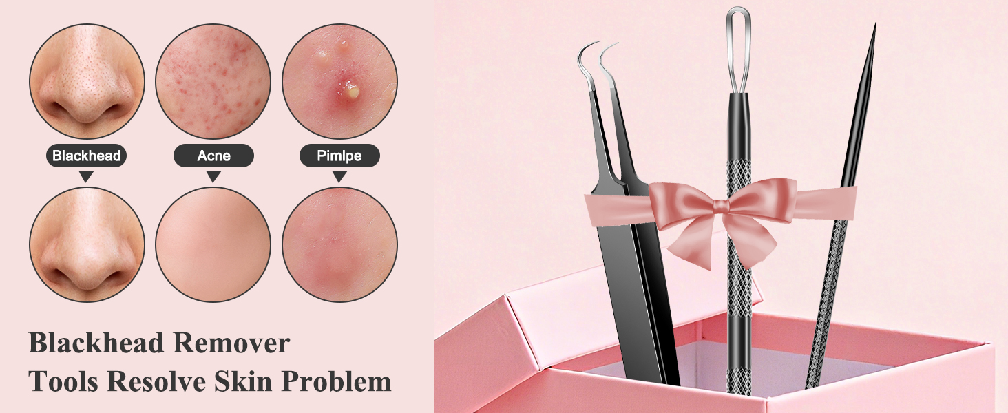 Blackhead Pimple Extractor