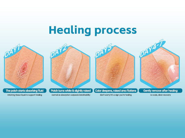 Healing process