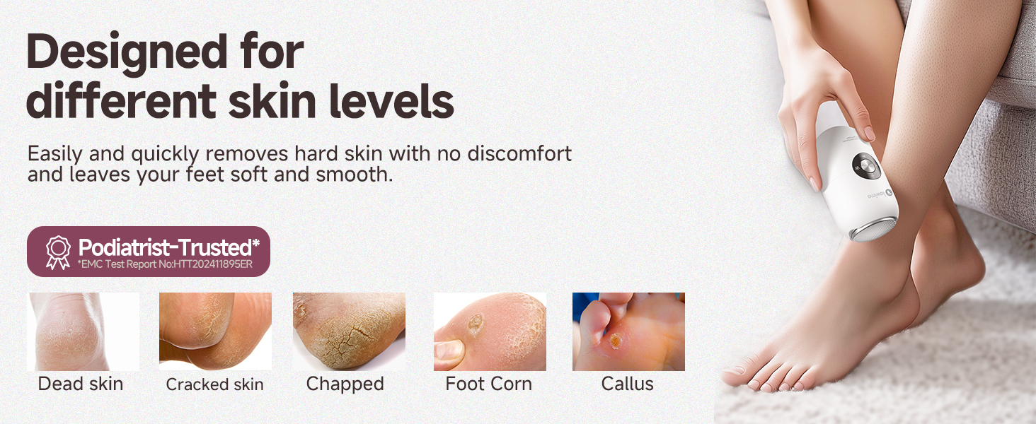 Electric Foot Callus Remover