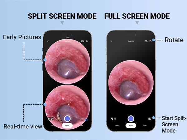Otoscope with Light Ear Camera Ear Scope Otoscope Camera