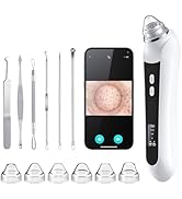 Blackhead Remover Vacuum, USB Interface Type Pore Vacuum, Black Head Extractions Tool with Camera...