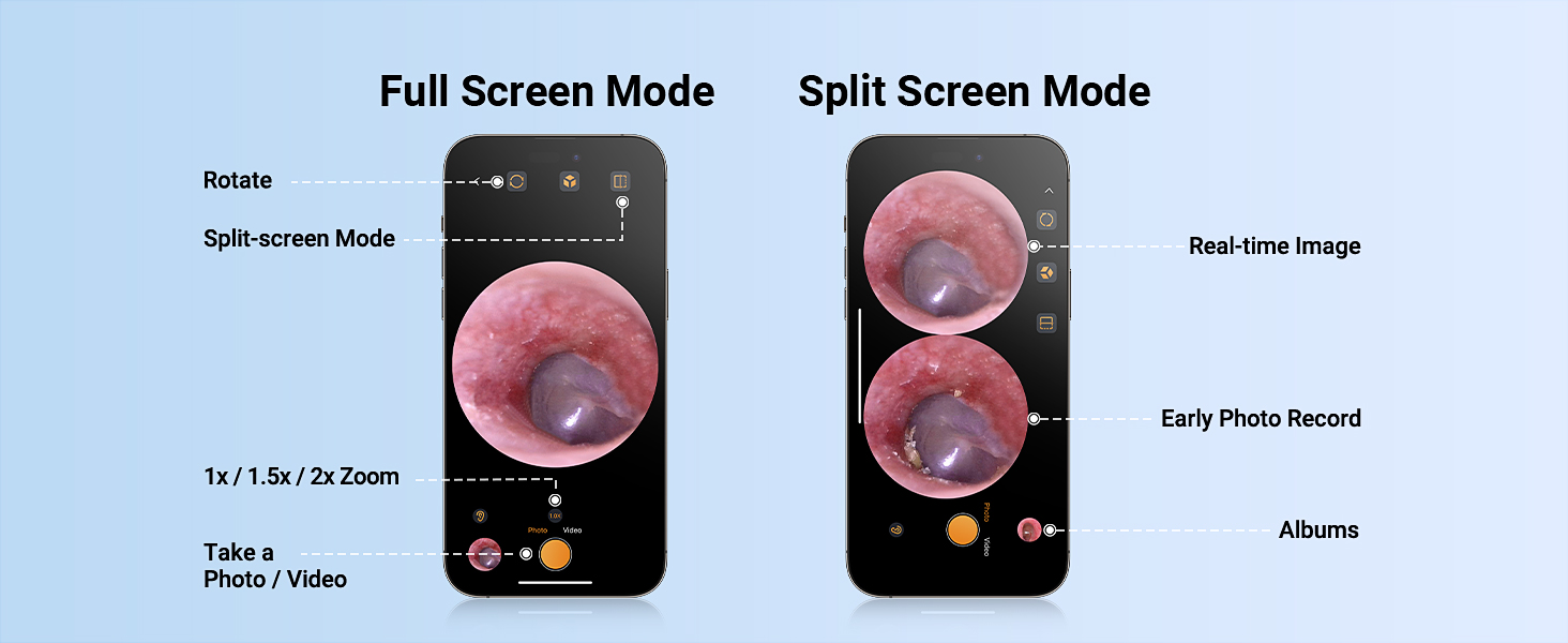otoscope with light ear scope digital otoscope for kids smart otoscope for iphone