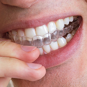 aligner cleaner aligner and retainer cleaner aligner cleaner foam mouthpiece cleaner retainer foam