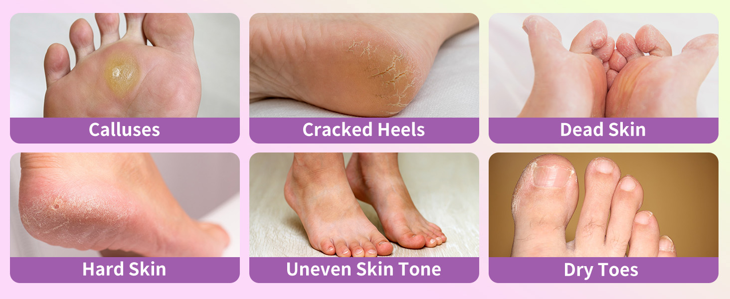 feet peeling mask