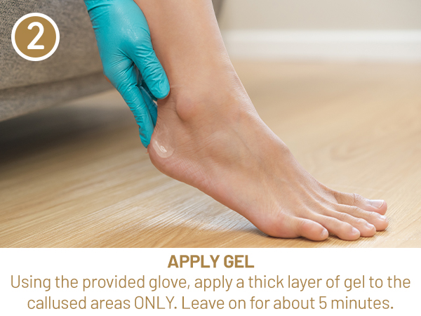 Apply Gel