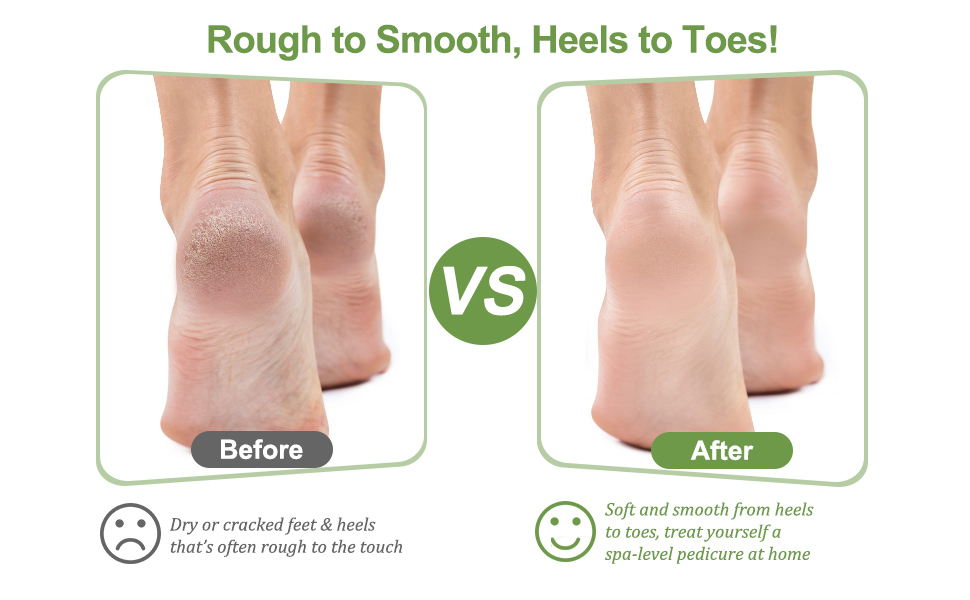 foot exfoliator, foot scrubber