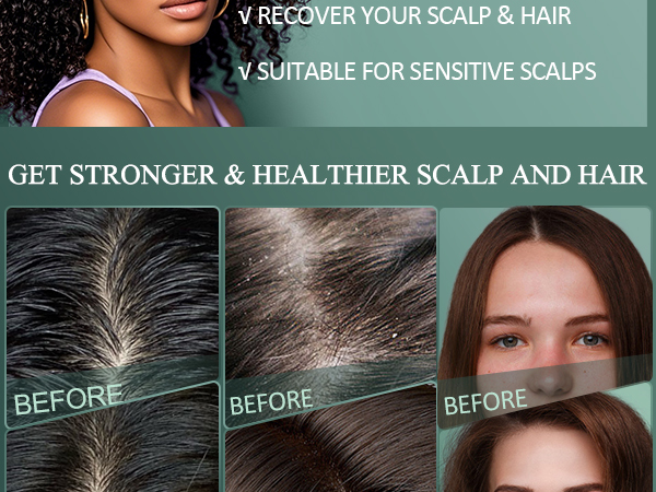 scalp scrub