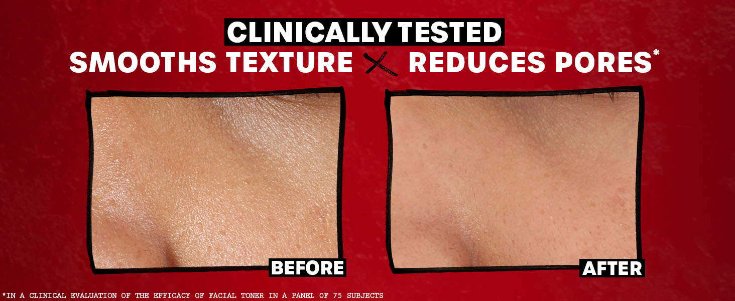 thayers toner
