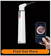 MOBI CONNECT Wi-Fi Otoscope for Ears, Nose & Throat - 1080P HD Lens, Multi-Axis Gyroscope, 6 LED