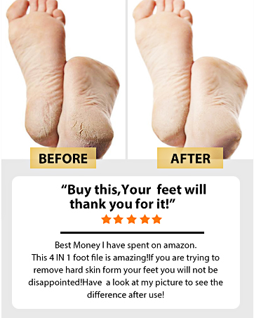 foot file before after