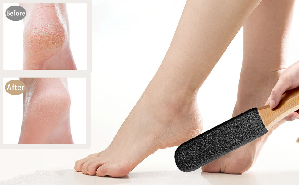 Foot File