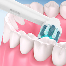 Close-up images of dental models and oral hygiene tools, showing white tooth models and dental care implements.