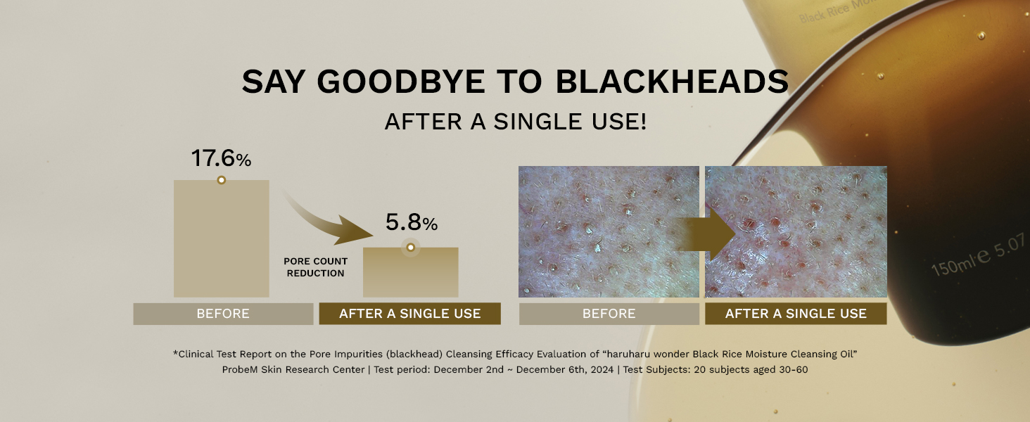 say goodbye to blackheads after single uses