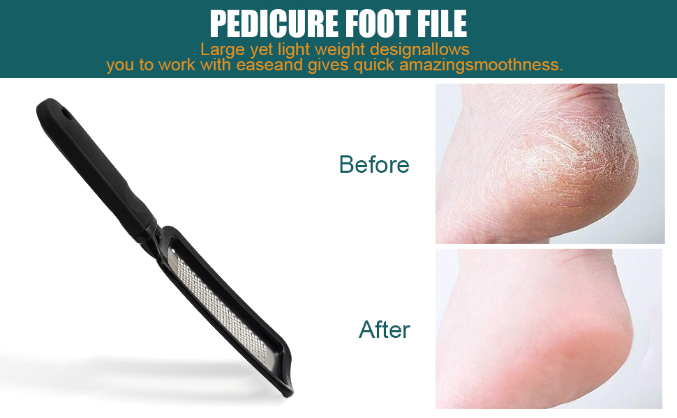 Colossal Pedicure Rasp Foot File, Professional Foot Care Stainless Steel File to Removes Hard Skin