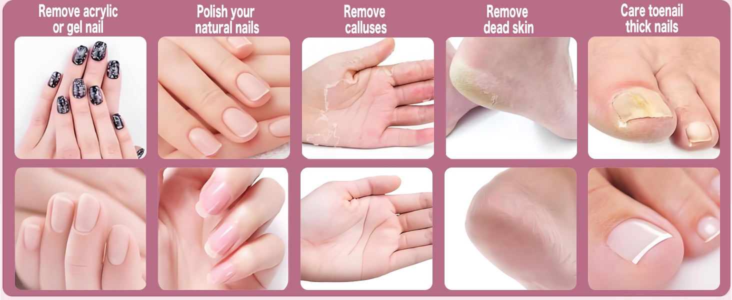 Portable Electric Foot Callus Remover & Nail Dril