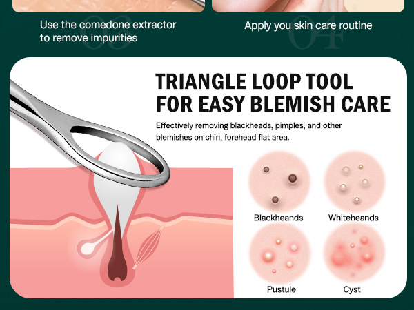Blackhead and Acne Extractor Kit