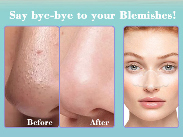 Nose Pore Patches