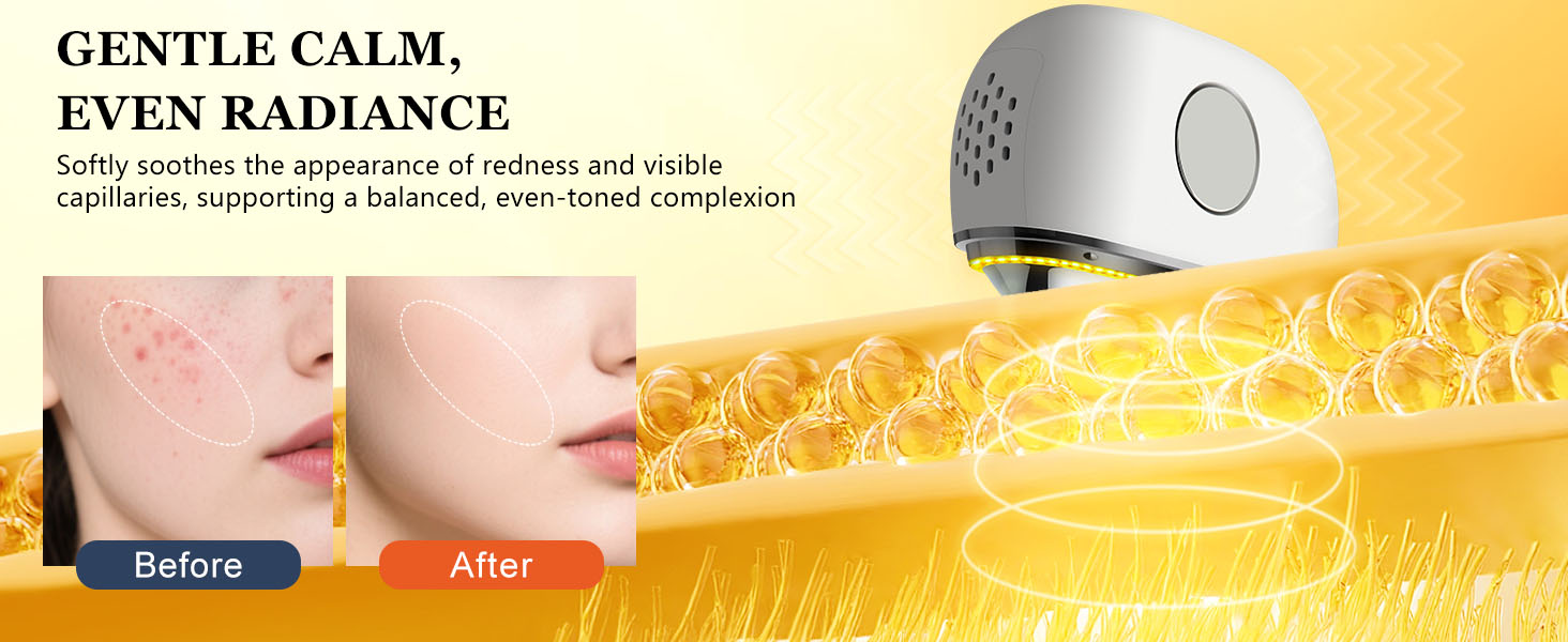 Yellow Light – Gently Calm Surface Redness