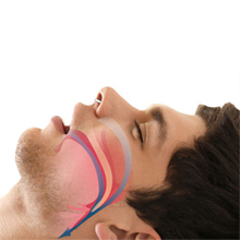 snore vent solutions device men
