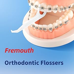 orthodontic flossers for braces