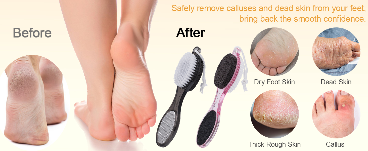 4-in-1 Foot Brush and Pumice Stone for Feet