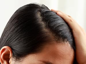 Healthy Scalp