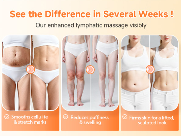Lymphatic Drainage Massager and Anti Cellulite Massage Tool