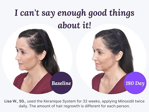 Keranique Scalp Massager Silicone Head Scrubber Hair Growth Stimulator Shower Massage Stress Relax.