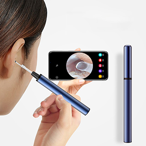 ear wax removal with camera