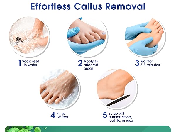 foot scrubber callus remover for feet pedicure tools for feet foot spa cuticle remover
