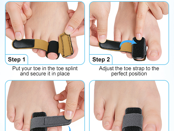Hammer Toe Straightener