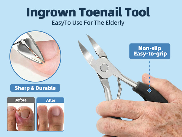 ingrown toenail tool