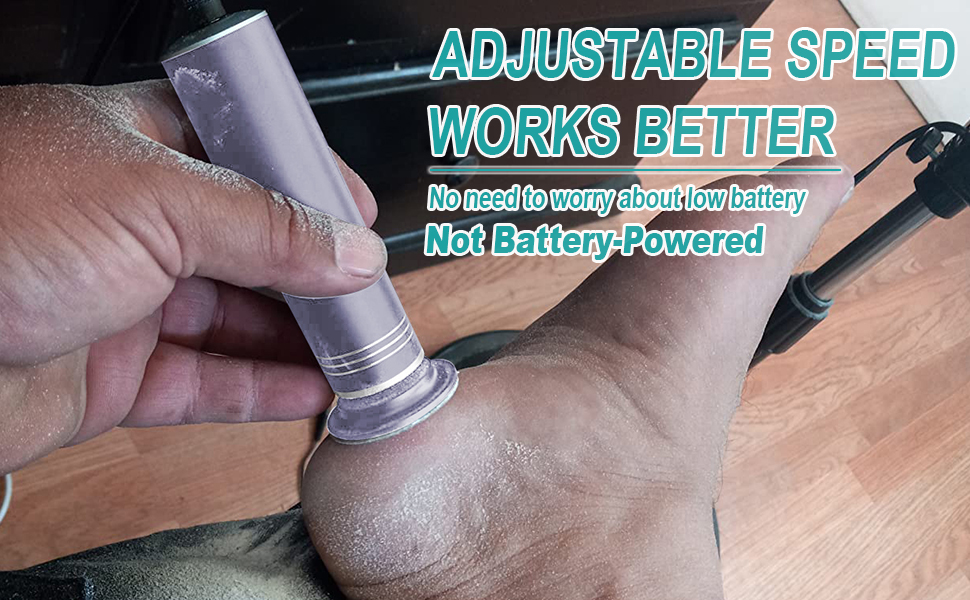 electric callus remover