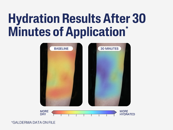 Hydration Results