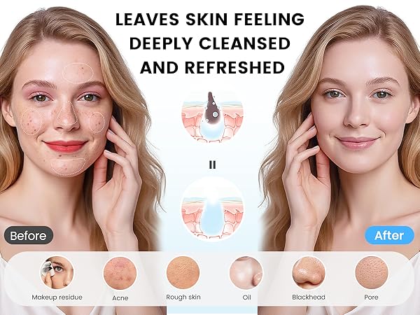 electric face scrubber