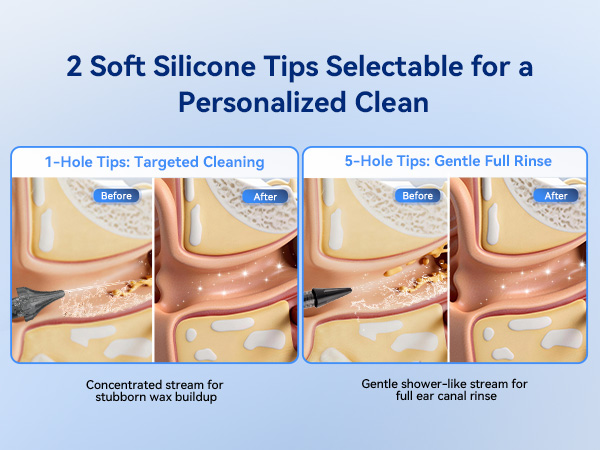 Smart Ear Cleaner_600x450_03-3