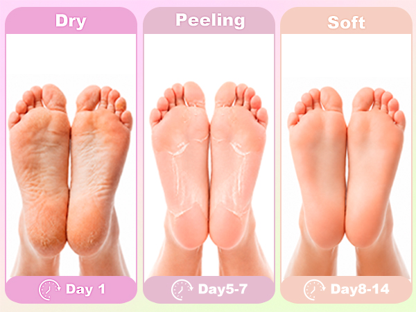 Foot Peeling Mask