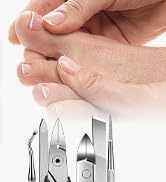 ingrown toenail treatment