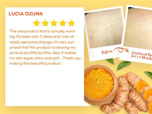 turmeric and kojic soap bar