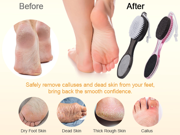 4-in-1 Foot Brush and Pumice Stone for Feet
